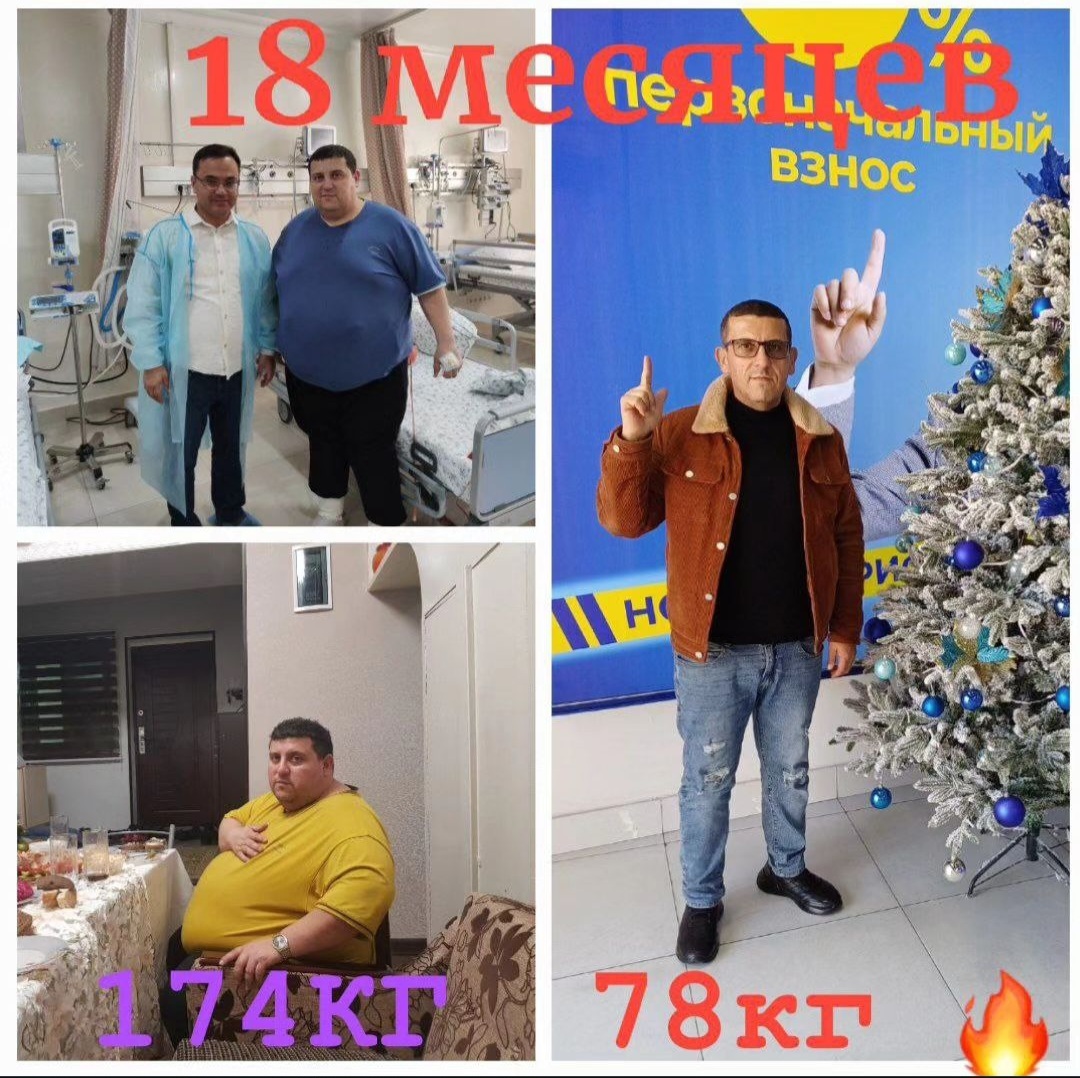 Do va Posle #1