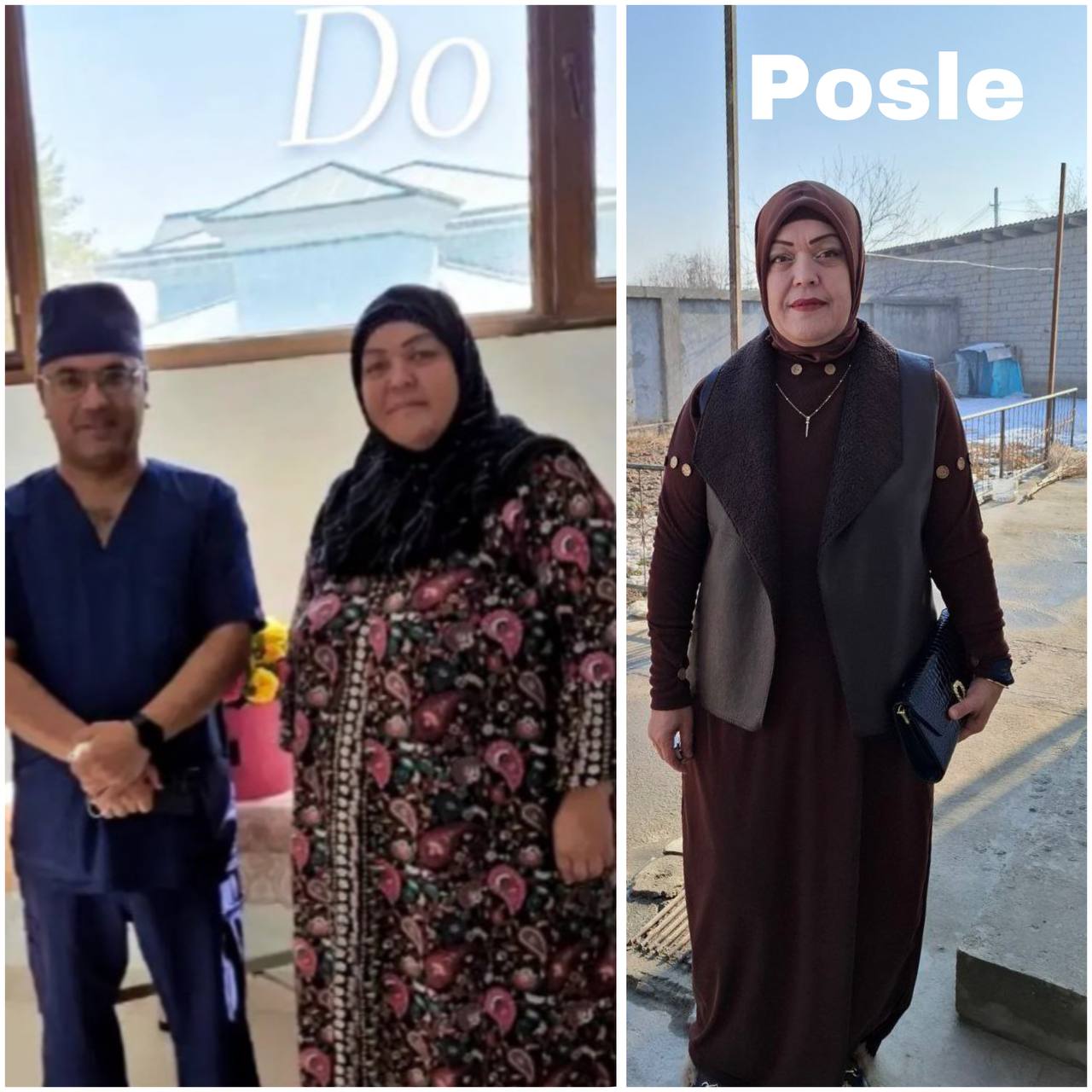 Do va Posle #10